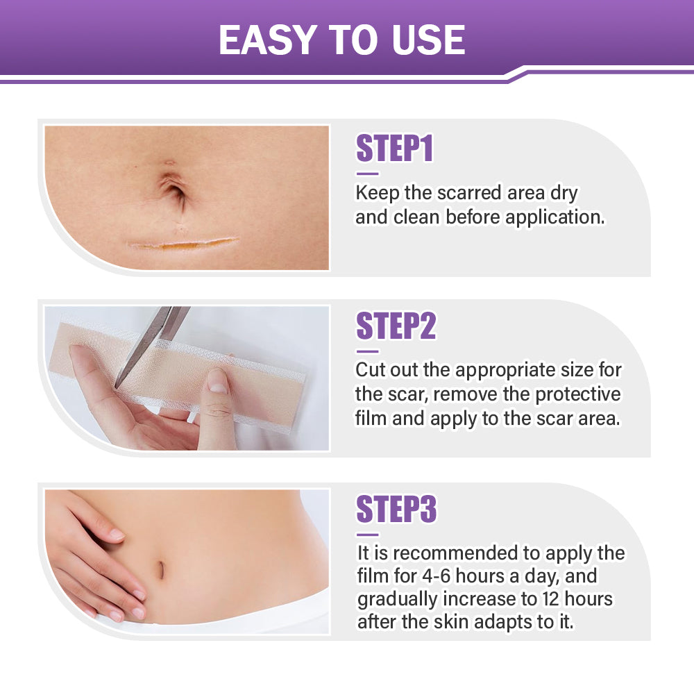 ✅Official Store |Ourlyard® Hyaluronic Acid Nano Microneedle Repair Tape🍁🏥(Treatment of old and new scars, reduction of surgical scars, stretch marks, keloids, acne, burns, warts, dermatomes and varicose veins)