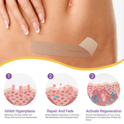 ✅Official Store |Ourlyard® Hyaluronic Acid Nano Microneedle Repair Tape🍁🏥(Treatment of old and new scars, reduction of surgical scars, stretch marks, keloids, acne, burns, warts, dermatomes and varicose veins)