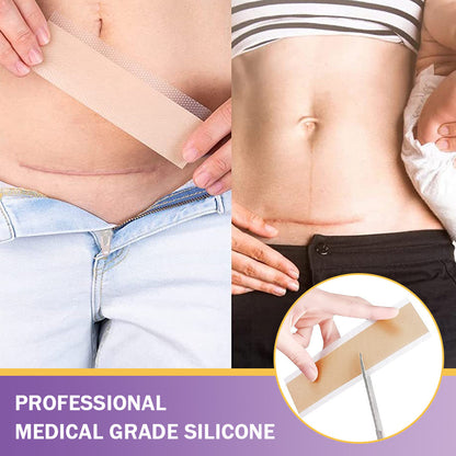 ✅Official Store |Ourlyard® Hyaluronic Acid Nano Microneedle Repair Tape🍁🏥(Treatment of old and new scars, reduction of surgical scars, stretch marks, keloids, acne, burns, warts, dermatomes and varicose veins)